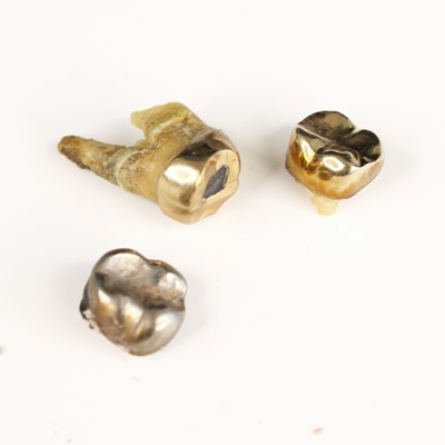 Lot 307 - Two yellow metal capped teeth, each cap tested...